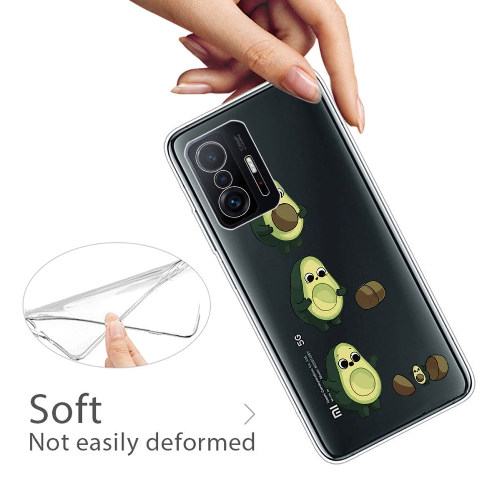 Xiaomi 11T / 11T Pro Fleksibelt Plast Deksel m. Trykk - Avokado